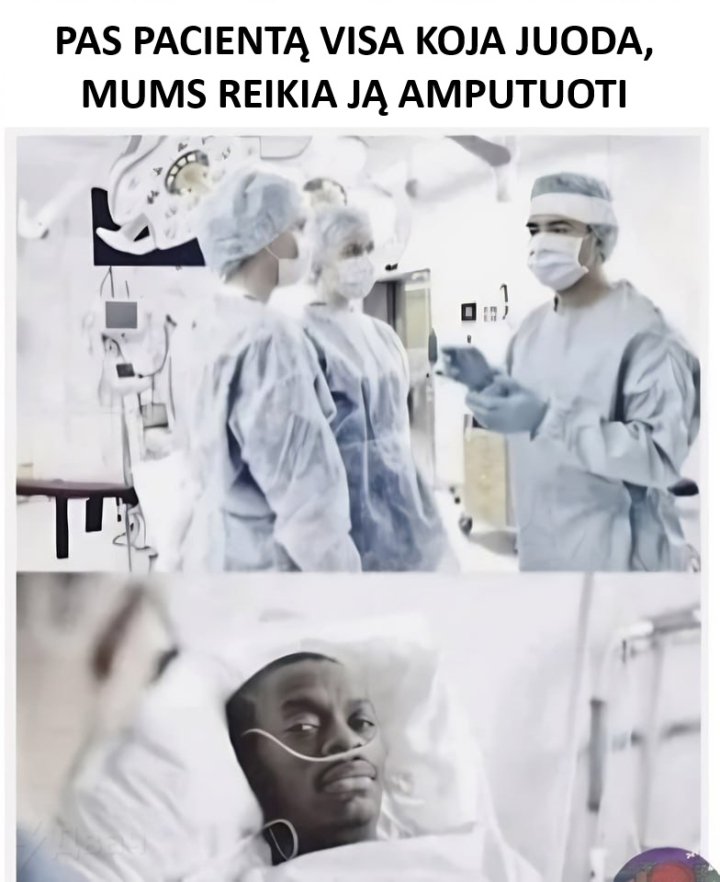 amputacija